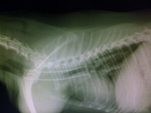 tracheal stent in place