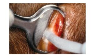 Figure 2. Cryosurgery for small eyelid margin tumor.